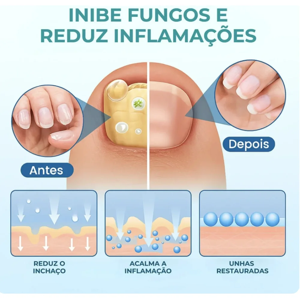 Bálsamo anti-fungos para unhas 4