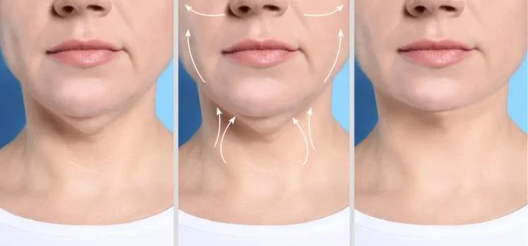 Creme de proteína collagen