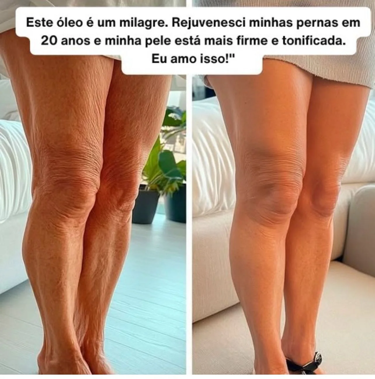 Creme de proteína collagen