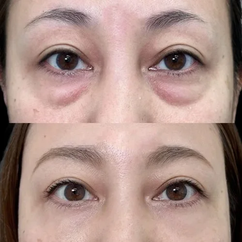 Creme de proteína collagen