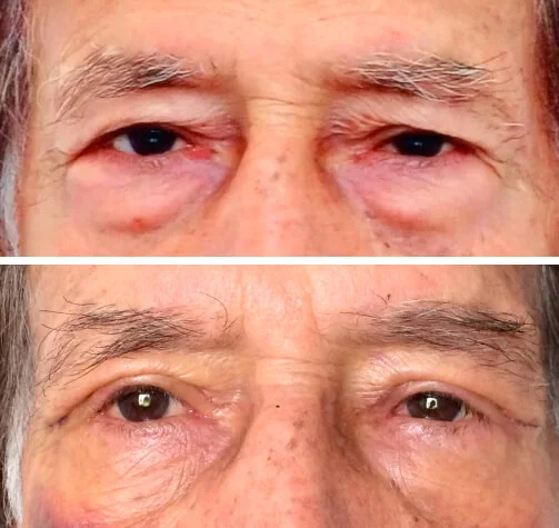Creme de proteína collagen