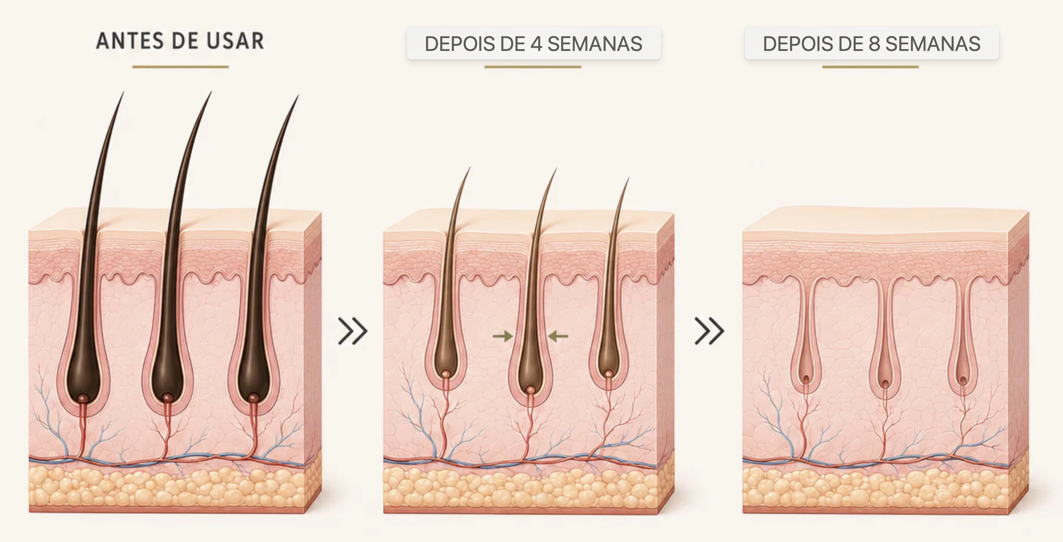 Óleo redutor de pelos