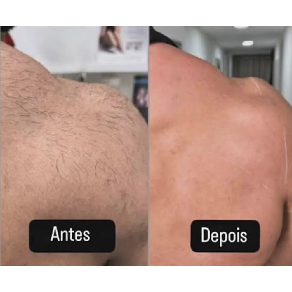 PeleLisa Gold - O Creme Que Vai Além da Depilação